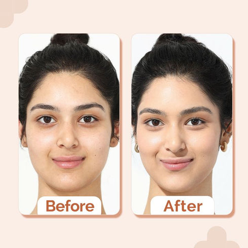 The Derma Co 2% Niacinamide High Coverage Foundation-03 Natural